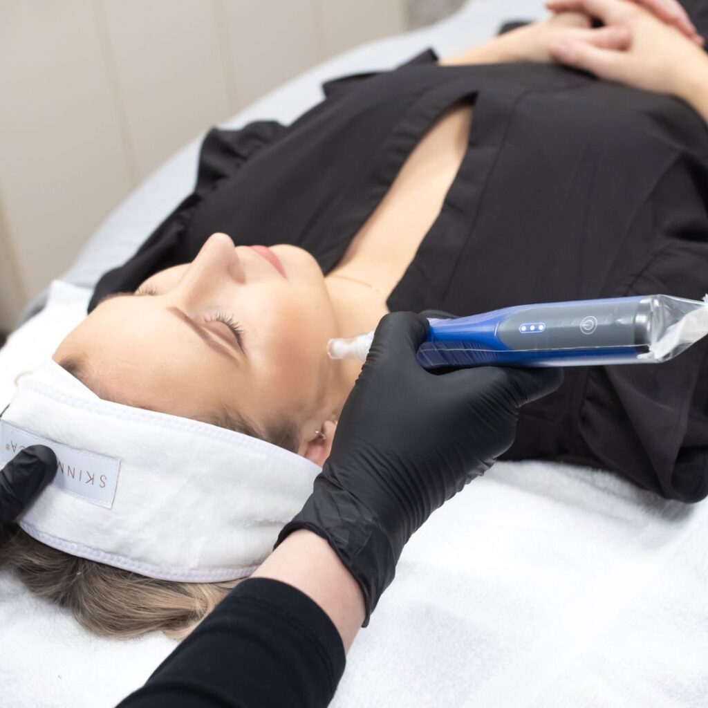 Microneedling - Collagen Induction Therapy