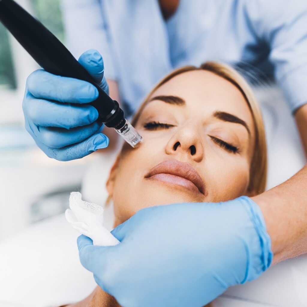 Woman receiving professional microneedling treatment to rejuvenate skin and improve texture.