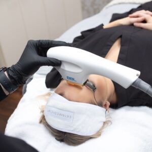 Patient receiving a BBL photofacial treatment on the forehead with a handheld device, wearing protective eyewear and a headband.