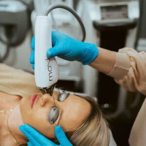 women laying down and getting a moxi treatment on her face